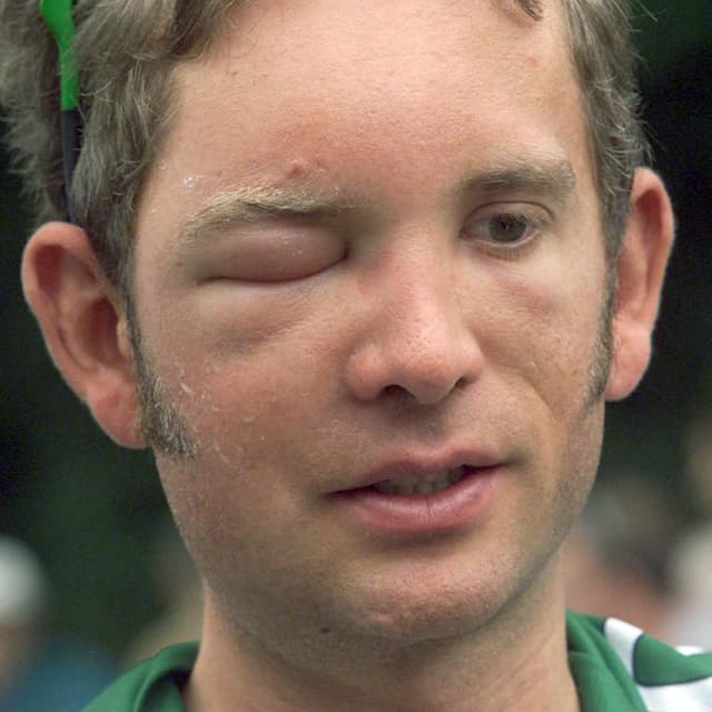 US Jonathan Vaughters of the Credit Agricole team poses during the 15th stage of the 88th Tour de France between Pau and Lavaur 24 July 2001. Vaughters stinged by a bee gives up the race.
AFP PHOTO (Photo by POOL / AFP)
